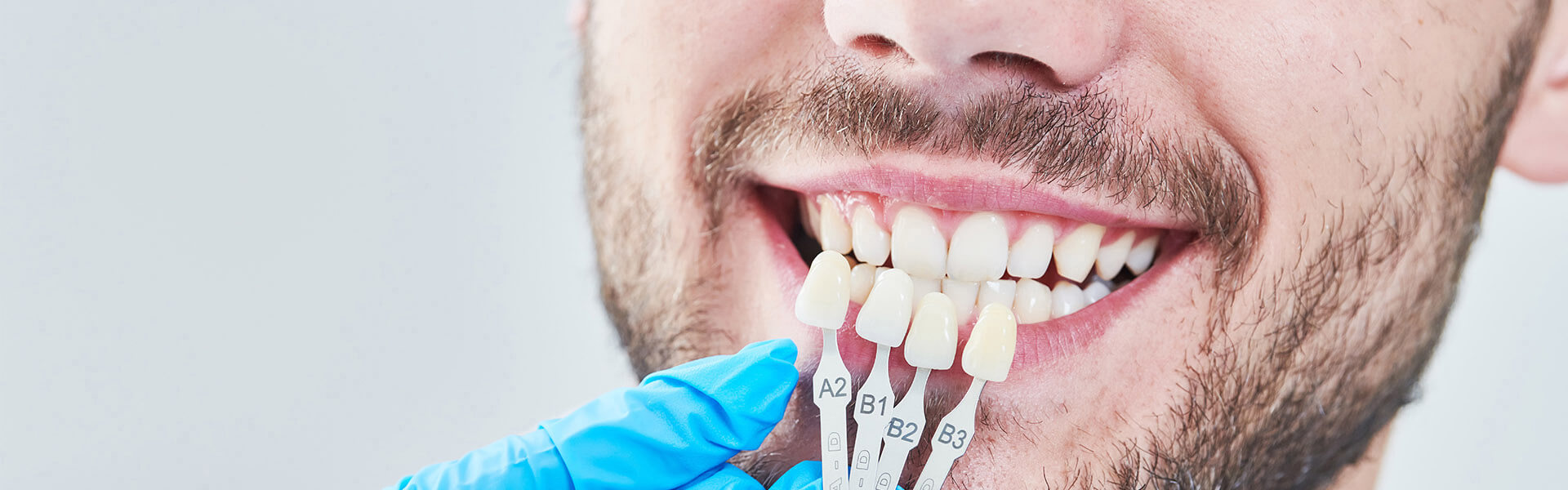 Dental Health and Teeth Veneers