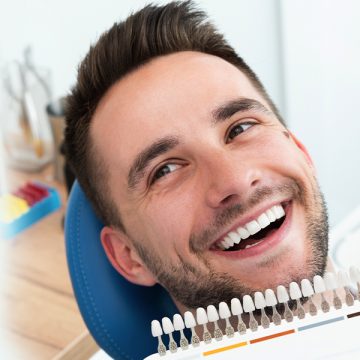 A Guide to Dental Veneers and How to Use Them